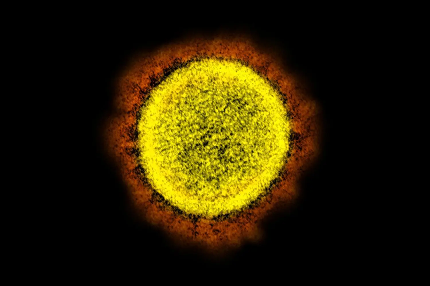 Eine elektronenmikroskopische Aufnahme zeigt ein von einem Patienten isoliertes Partikel des Coronavirus SARS-CoV-2 in einem Labor.