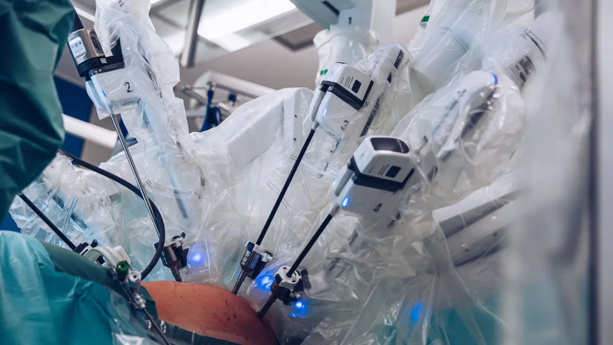 Bei einer robotergestützten Lungenoperation handelt es sich um einen schondenden Eingriff.