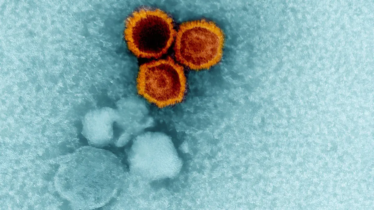 Epstein-Barr-Virus