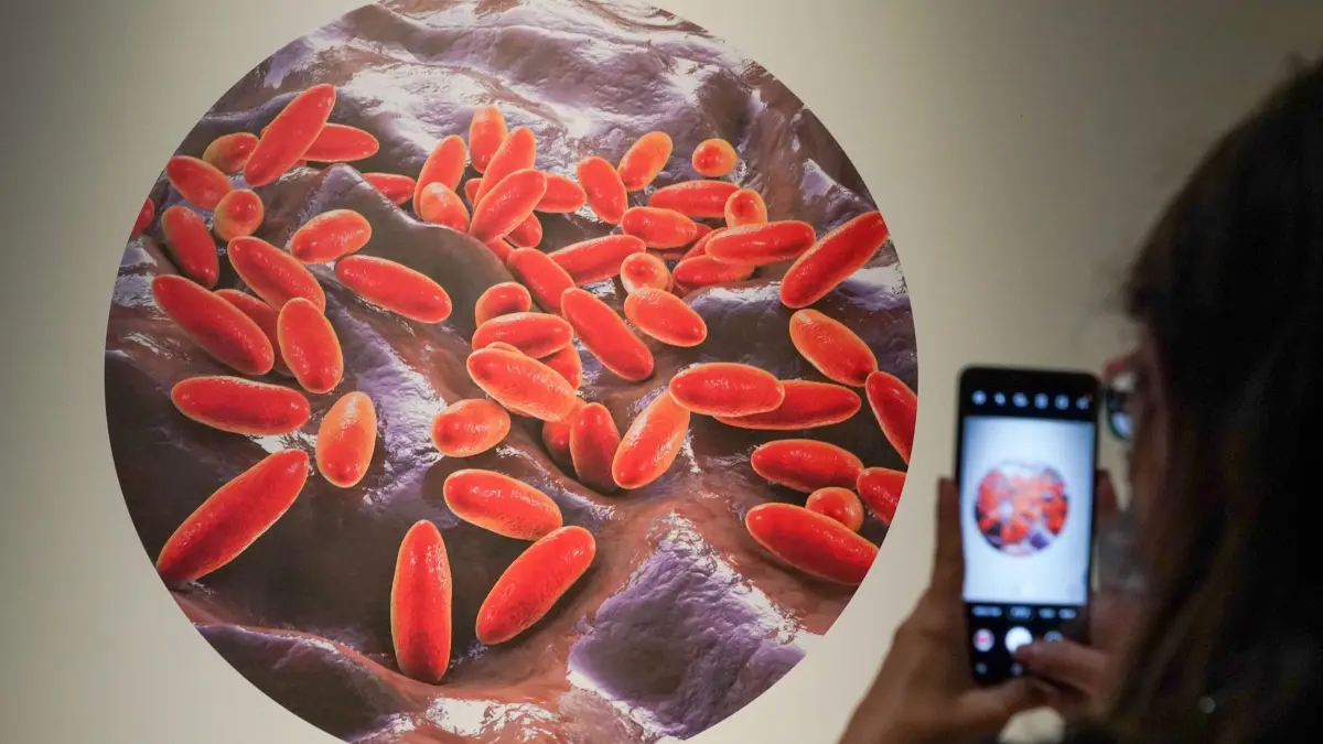 Das für die Lungenpest verantwortliche Bakterium.: ARCHIV - 19.08.2021, Sachsen-Anhalt, Wittenberg: Die Abbildung des für die Beulen- und Lungenpest verantwortlichen Bakteriums Yersinia pestis fotografiert eine Besucherin in der Ausstellung «Pest - eine Seuche verändert die Welt». Was Pestausbrüche im Mittelalter und die derzeitige Corona-Pandemie gemeinsam haben, zeigt die Ausstellung vom 20.08.2021-20.02.2022. (zu dpa: «Lungenpest-Verdacht: WHO bietet Russland Hilfe an») Foto: Peter Endig/dpa-Zentralbild/dpa +++ dpa-Bildfunk +++