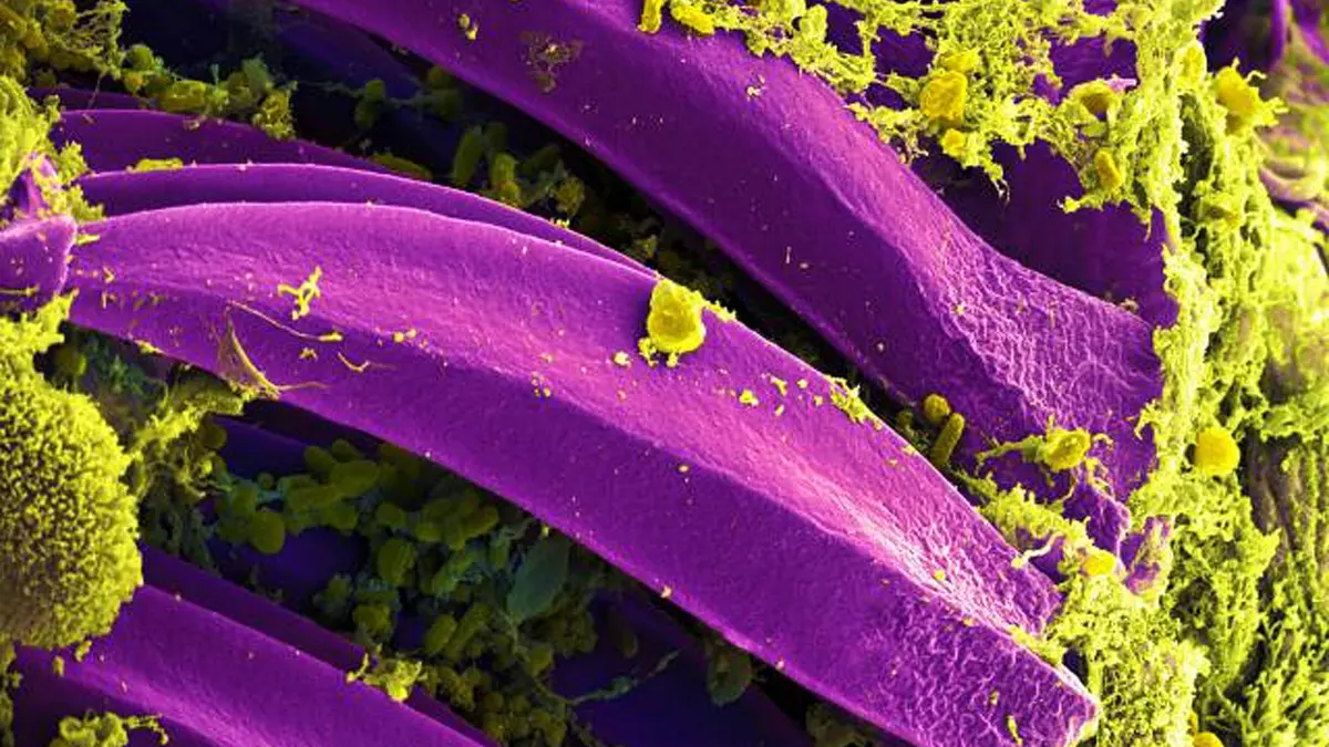 Kleiner Erreger, große Wirkung: Yersinia-pestis-Bakterium unter dem Elektronenmikroskop.