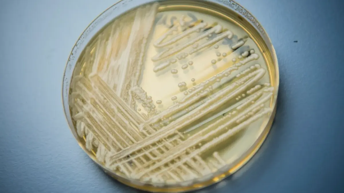 Petrischale mit Hefepilz Candidozyma auris: Auf Intensivstationen besonders gefährlich